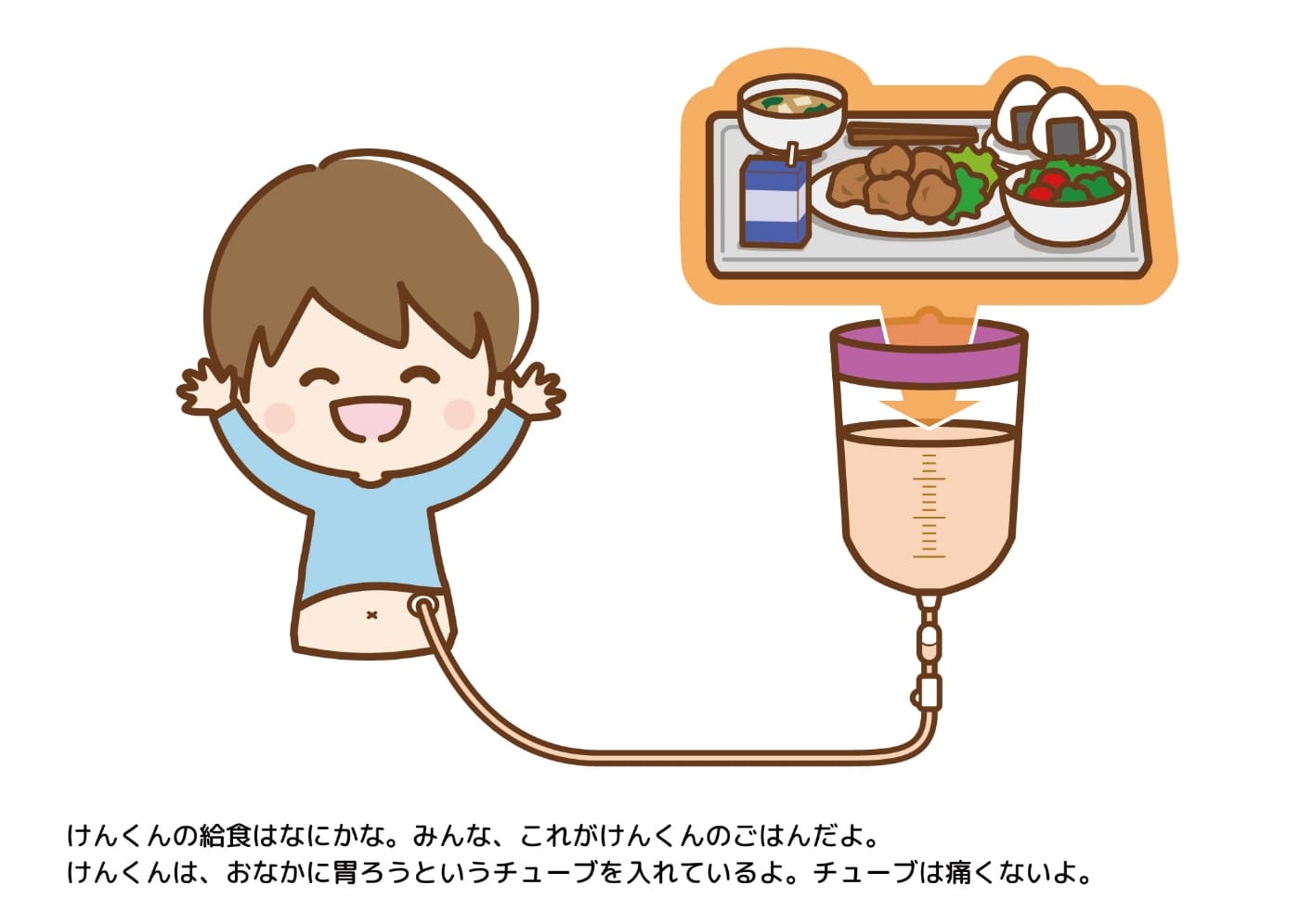 けんくんの給食はなにかな。みんな、これがけんくんのごはんだよ。けんくんは、おなかに胃ろうというチューブを入れているよ。チューブは痛くないよ。